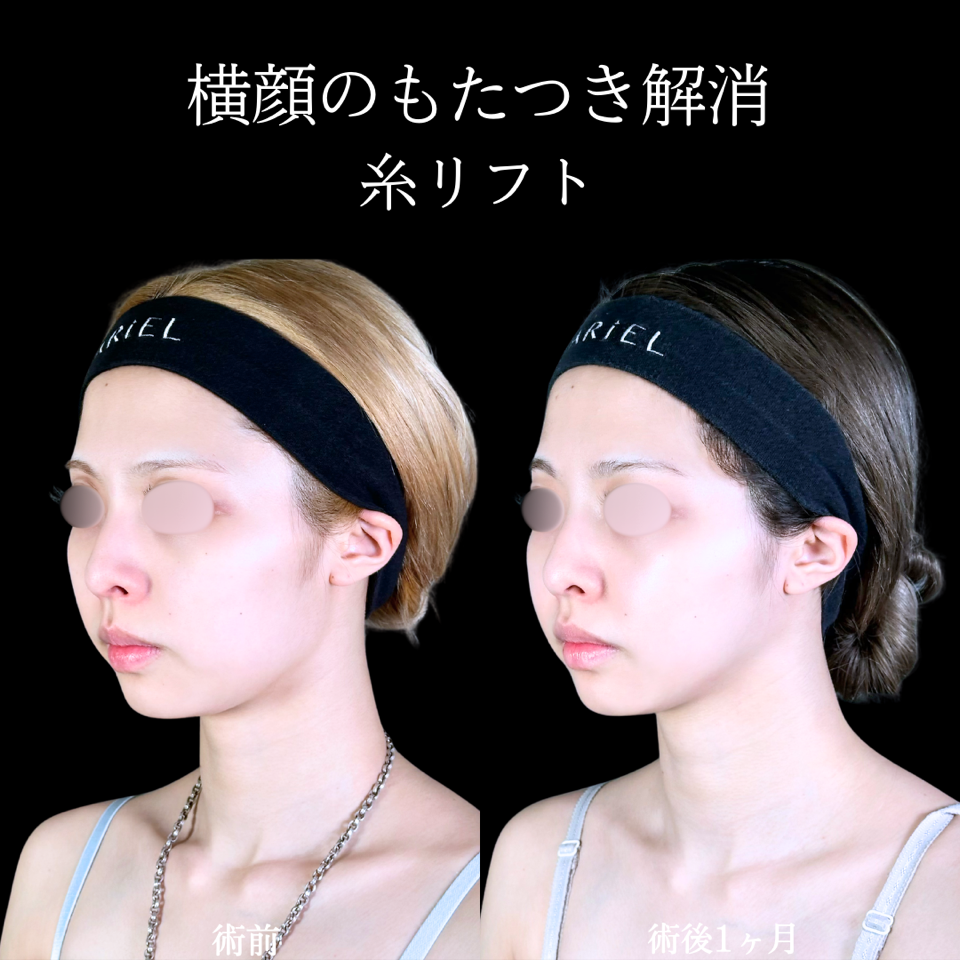 No.10802の症例写真