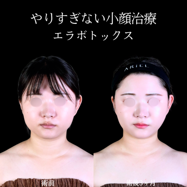 No.10763の症例写真