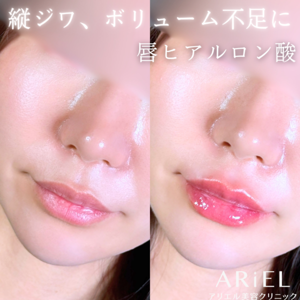 No.10833の症例写真 No.10833の症例写真