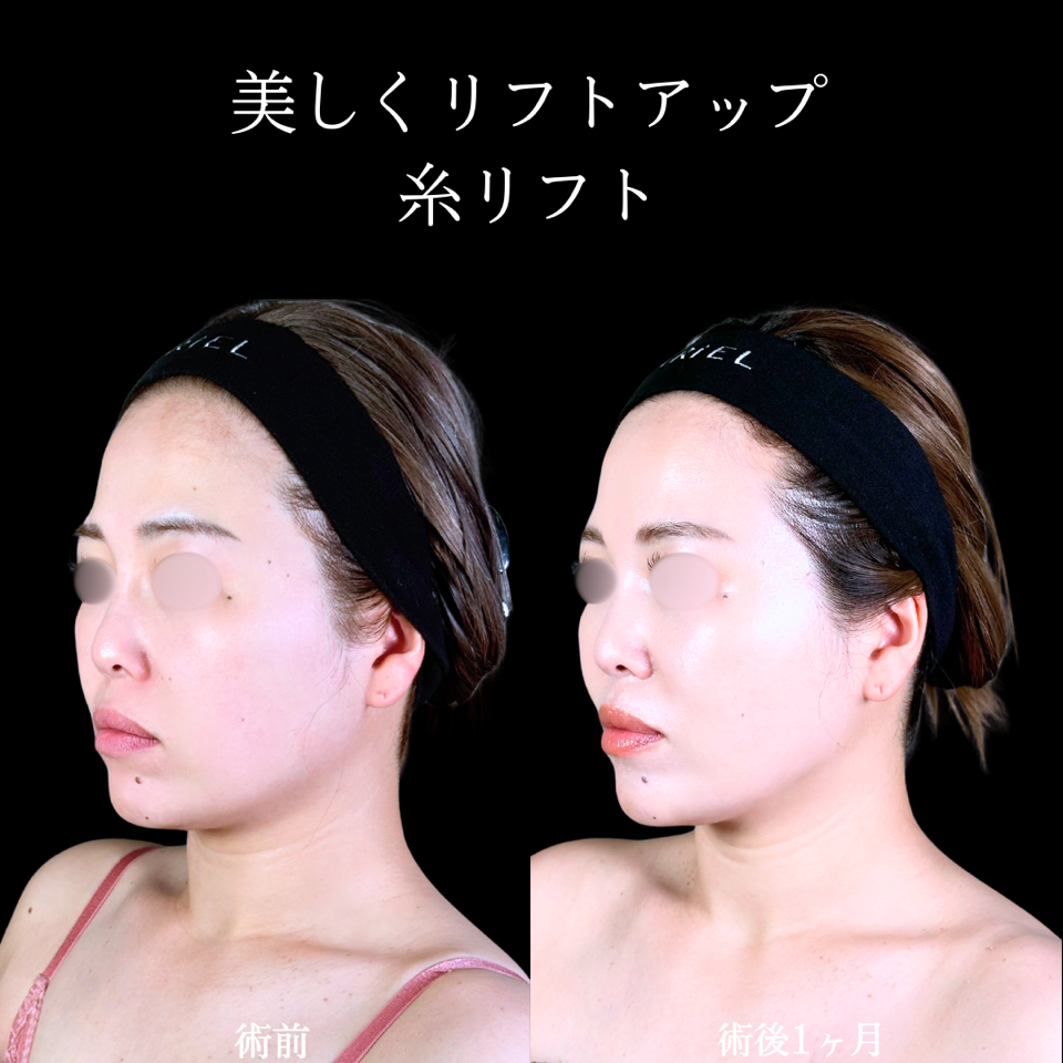 No.10840の症例写真