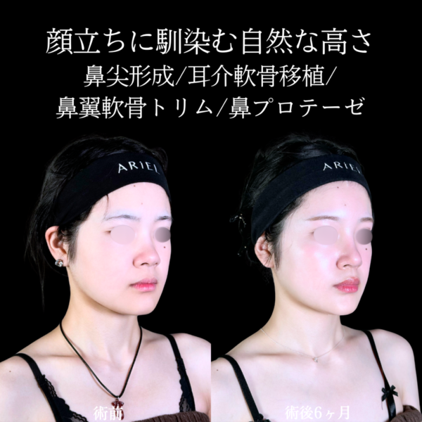 No.10770の症例写真