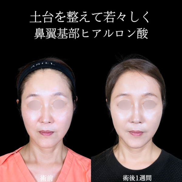 No.10542の症例写真 No.10542の症例写真