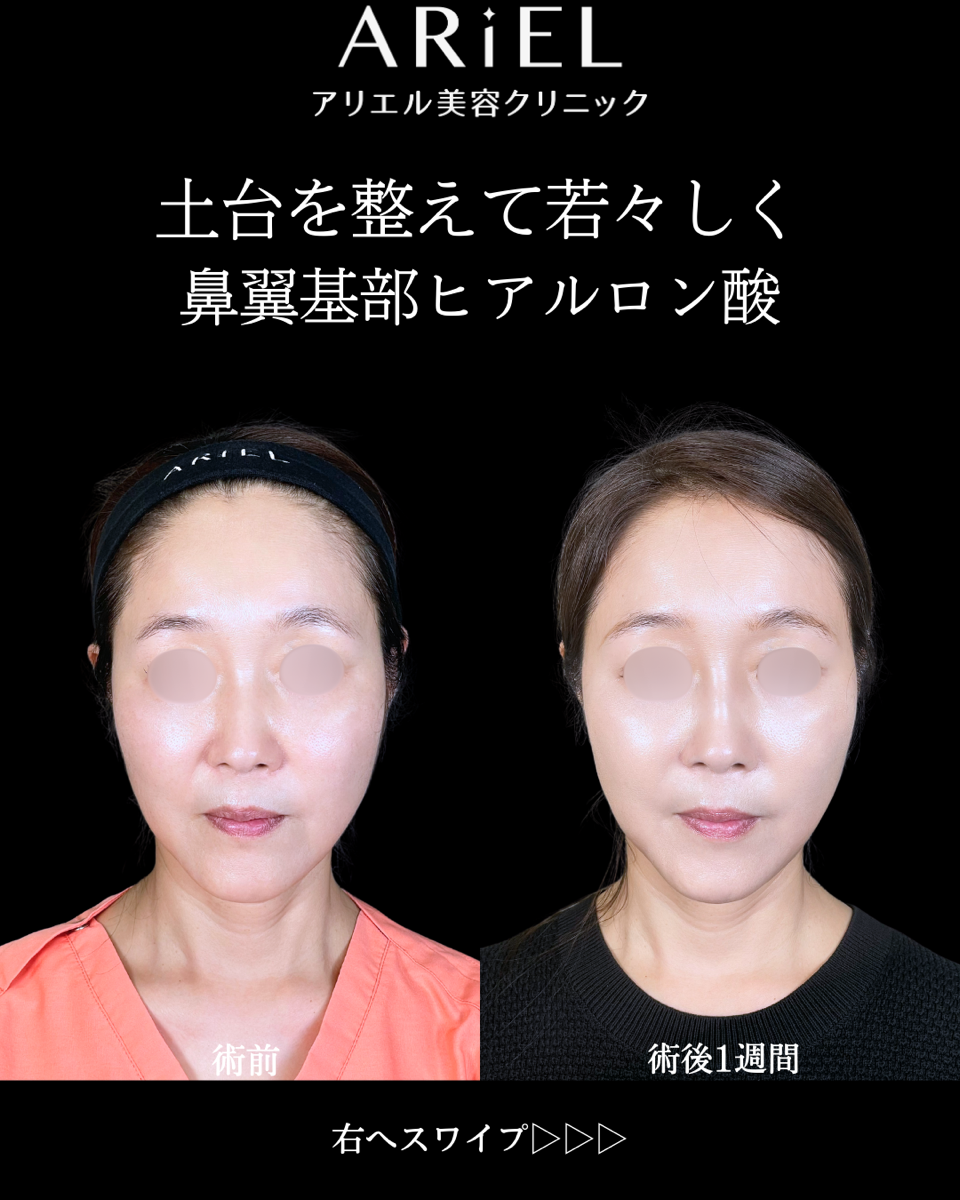 No.10542の症例写真