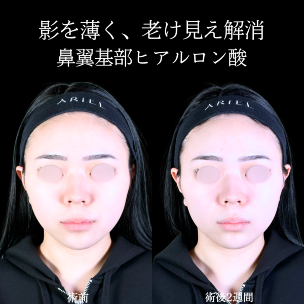 No.10858の症例写真 No.10858の症例写真