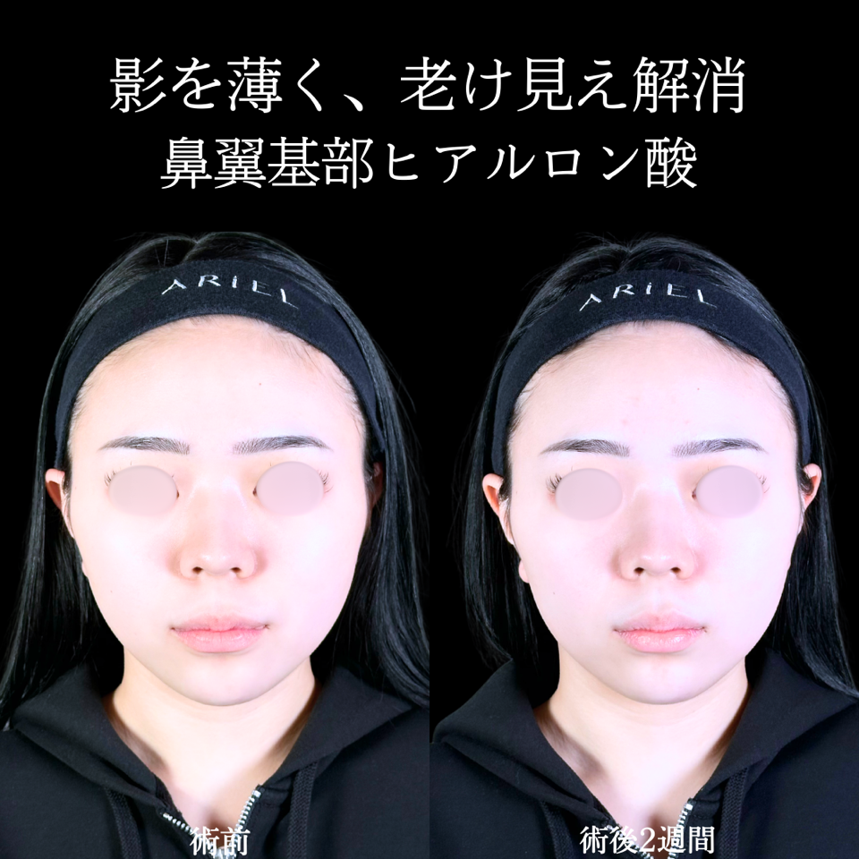 No.10858の症例写真