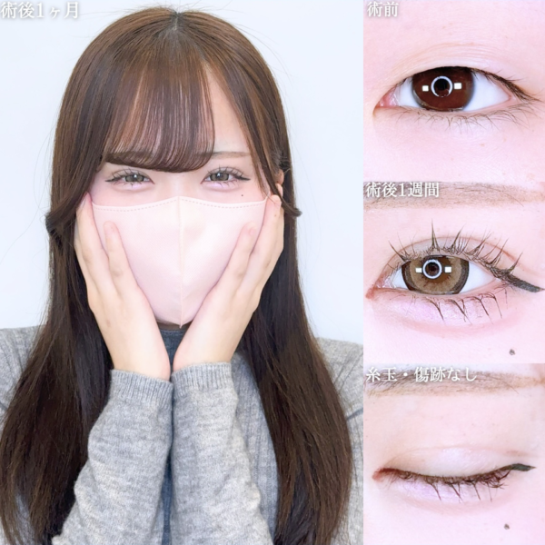 No.11021の症例写真