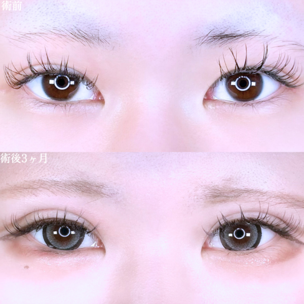 No.10820の症例写真 No.10820の症例写真