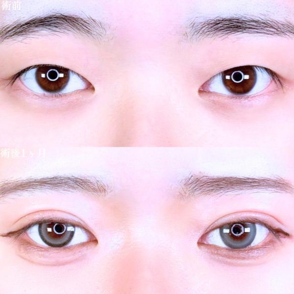 No.10663の症例写真 No.10663の症例写真