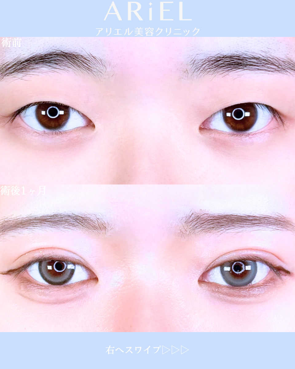 No.10663の症例写真