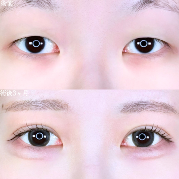 No.10674の症例写真 No.10674の症例写真