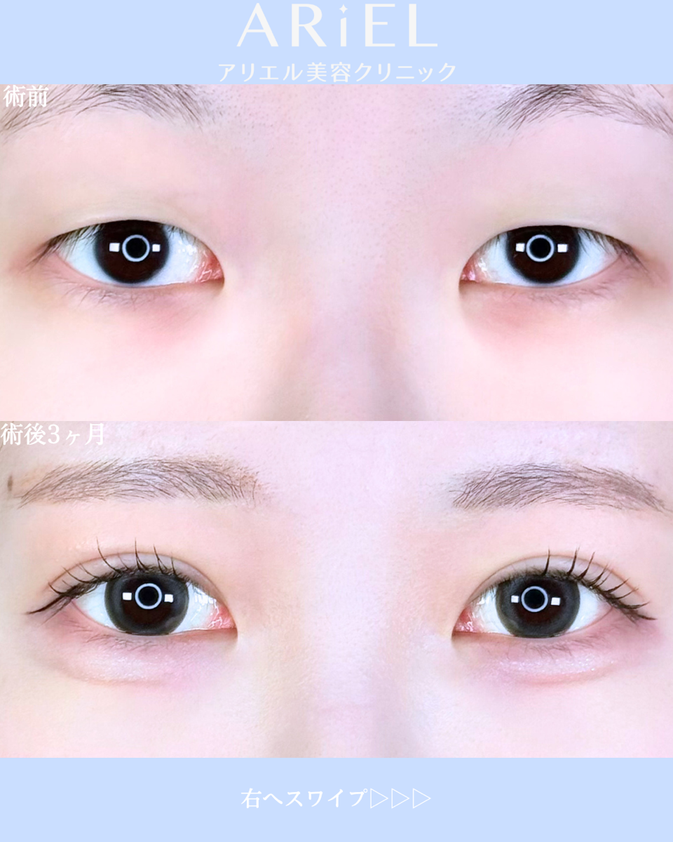 No.10674の症例写真