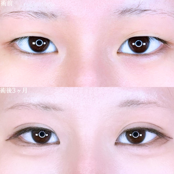 No.10698の症例写真