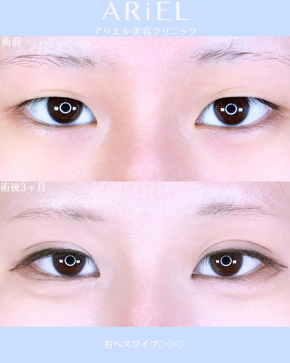 No.10698の症例写真