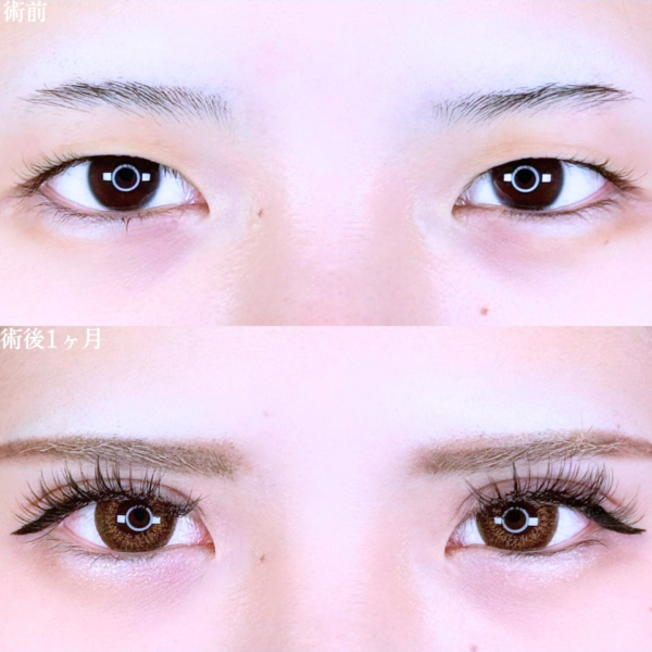 No.10529の症例写真 No.10529の症例写真