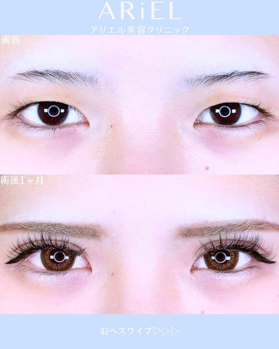 No.10529の症例写真