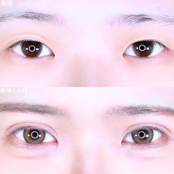 No.10560の症例写真