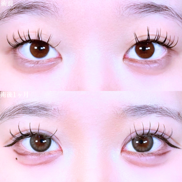 No.10597の症例写真