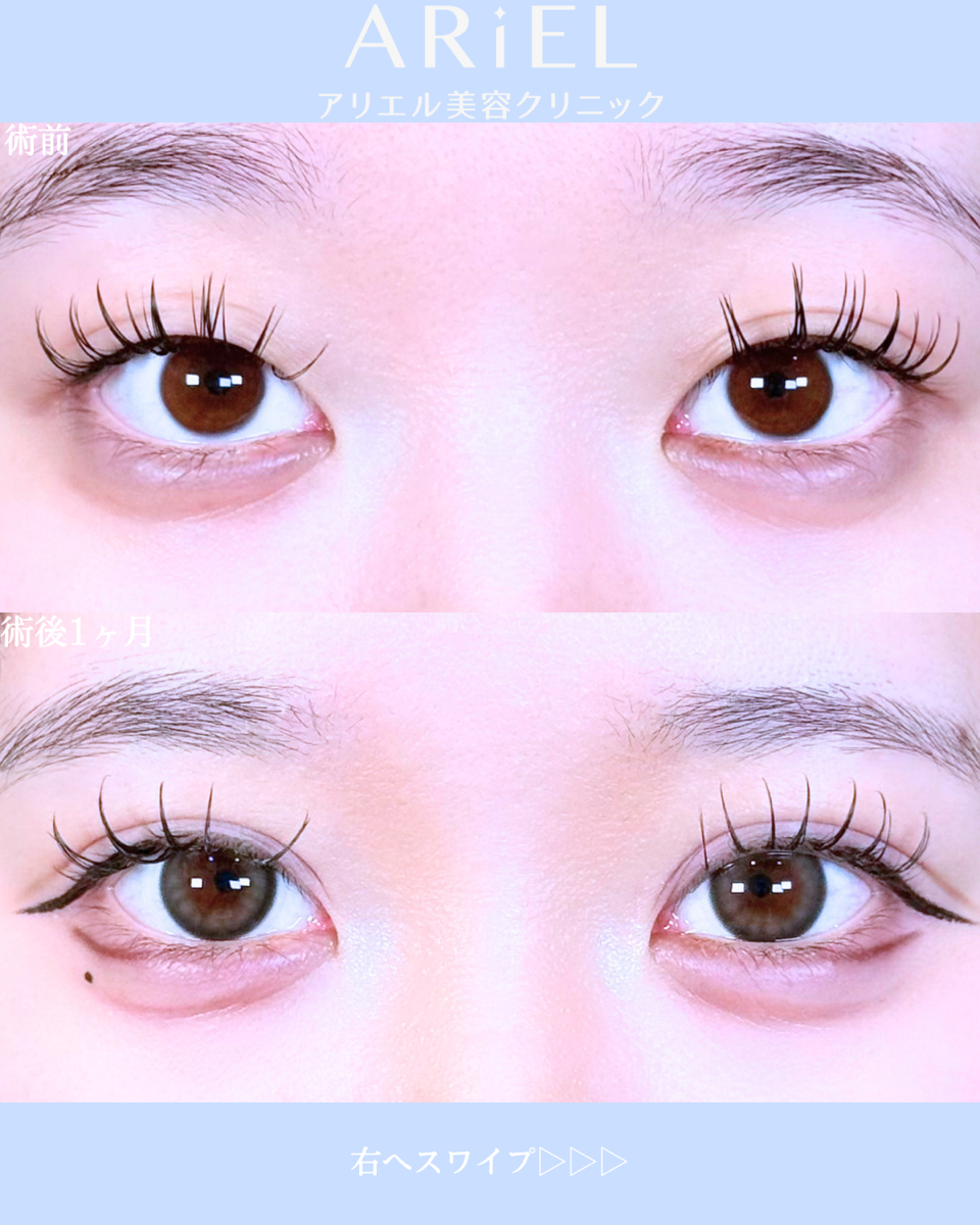 No.10597の症例写真