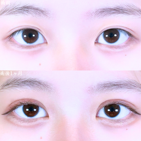 No.10609の症例写真