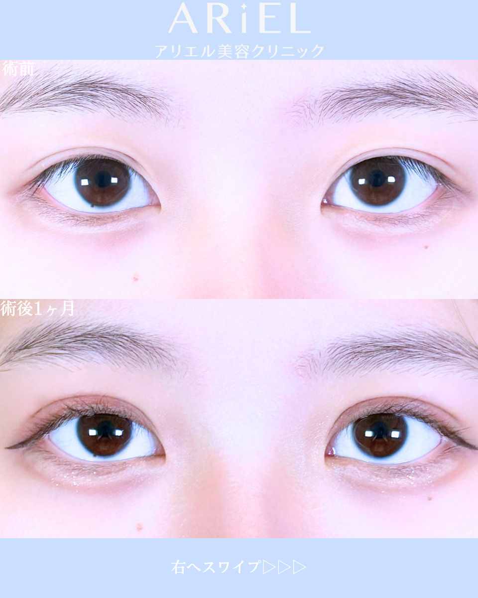 No.10609の症例写真