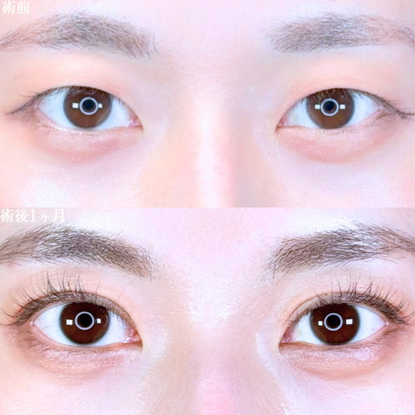 No.10639の症例写真