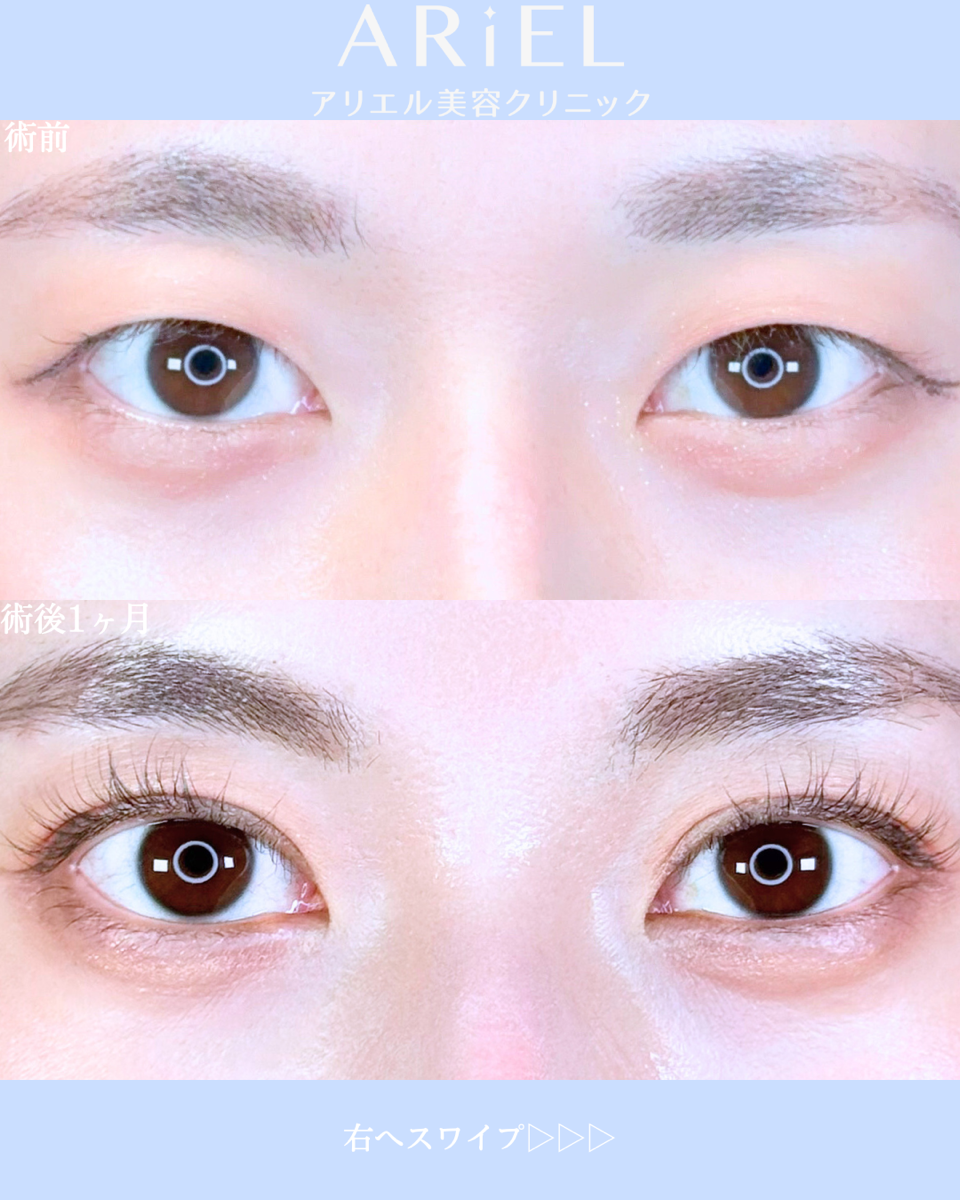 No.10639の症例写真