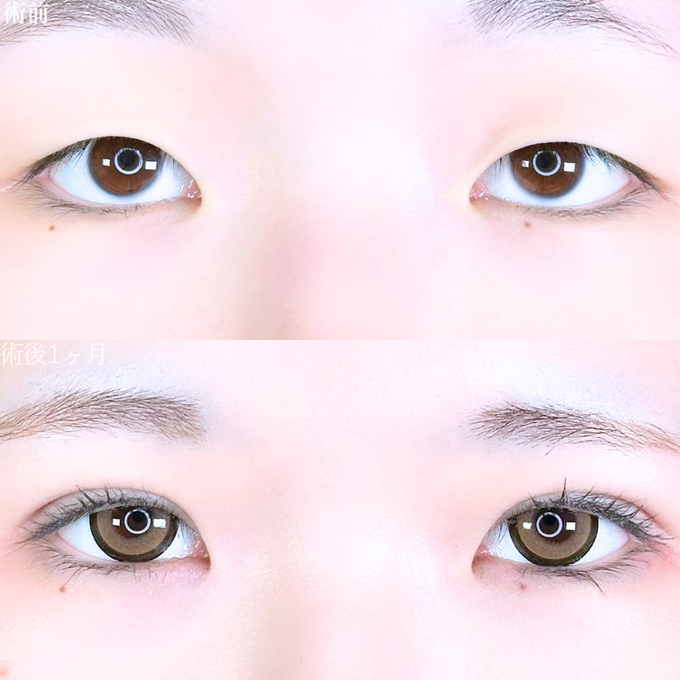 No.10826の症例写真