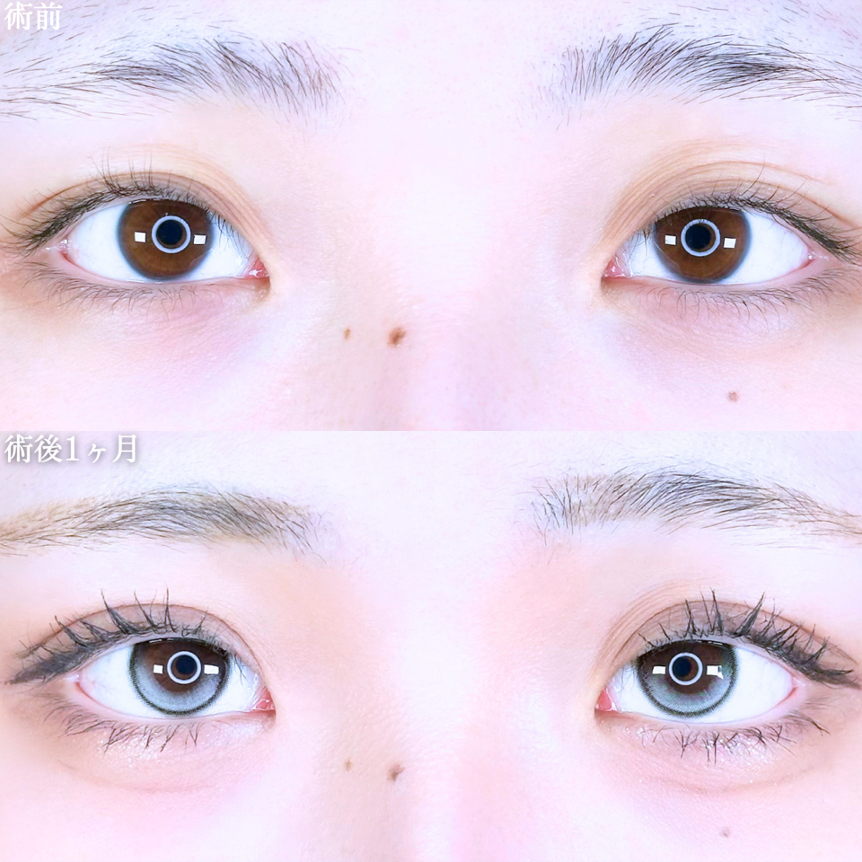 No.10865の症例写真