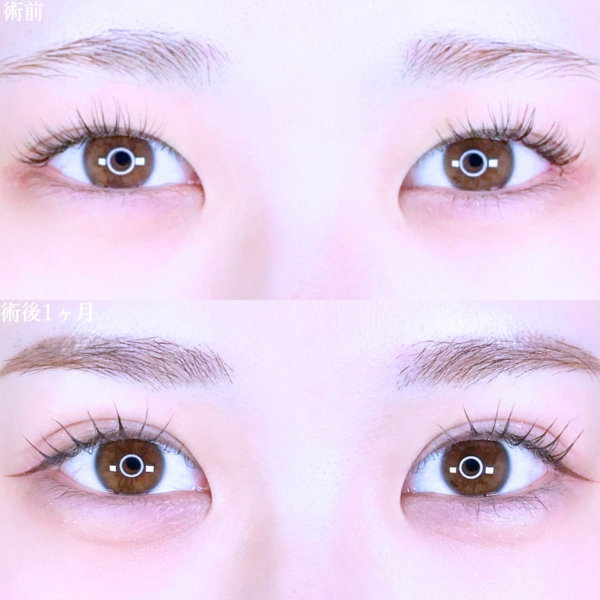 No.10627の症例写真