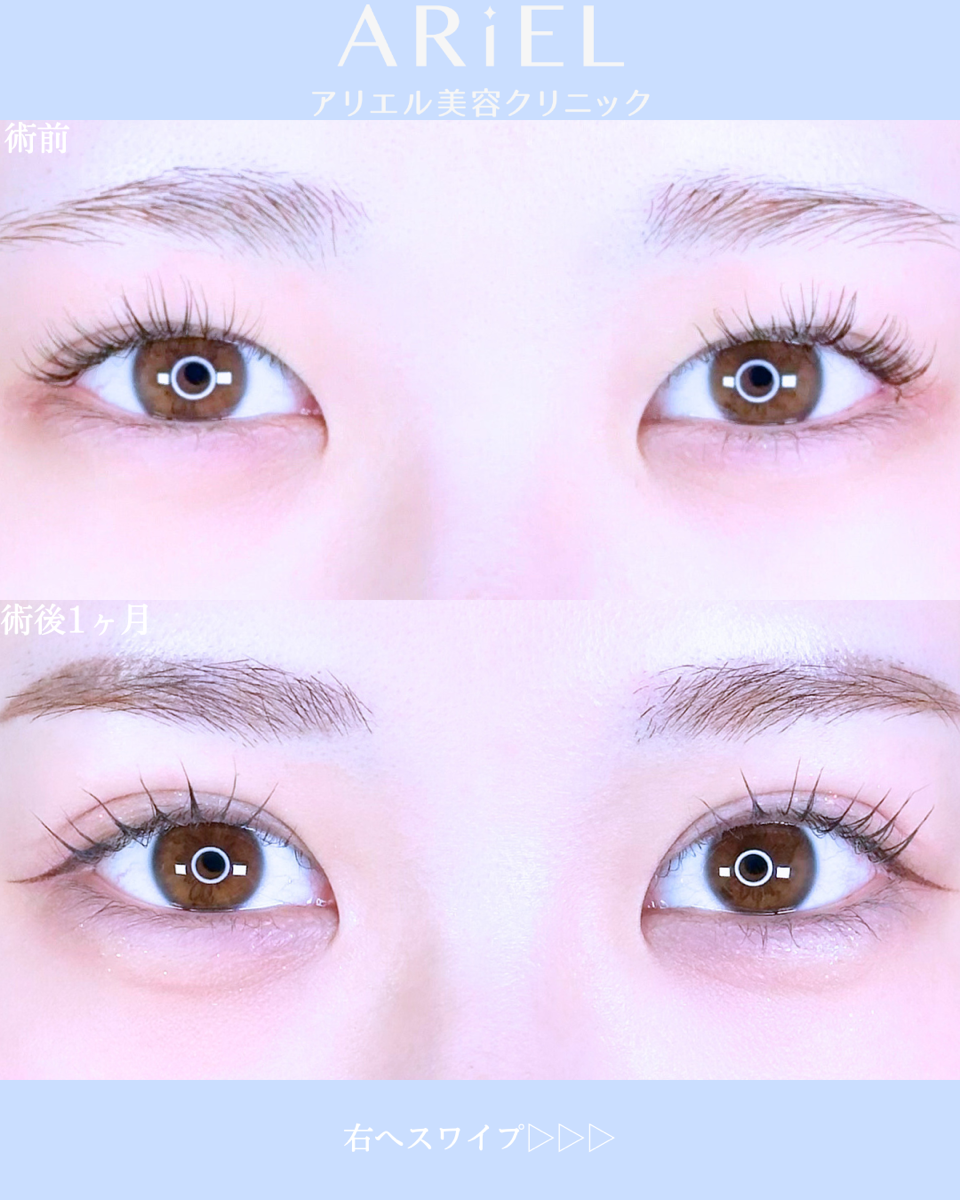 No.10627の症例写真