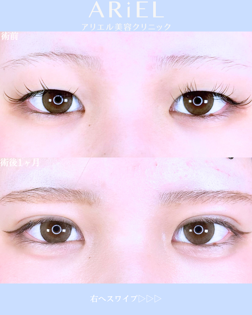 No.10669の症例写真