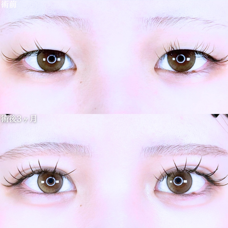 No.10871の症例写真