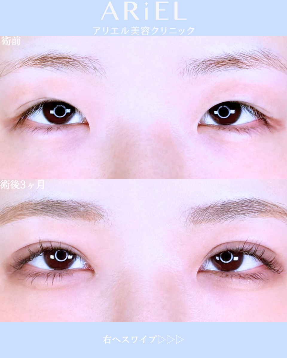 No.10555の症例写真