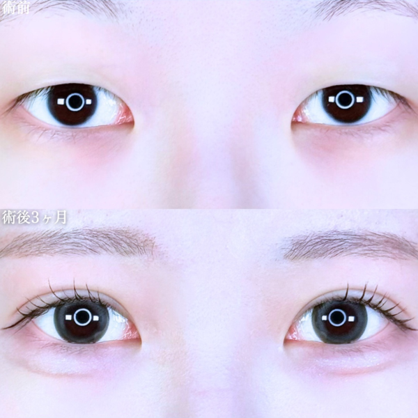 No.10980の症例写真