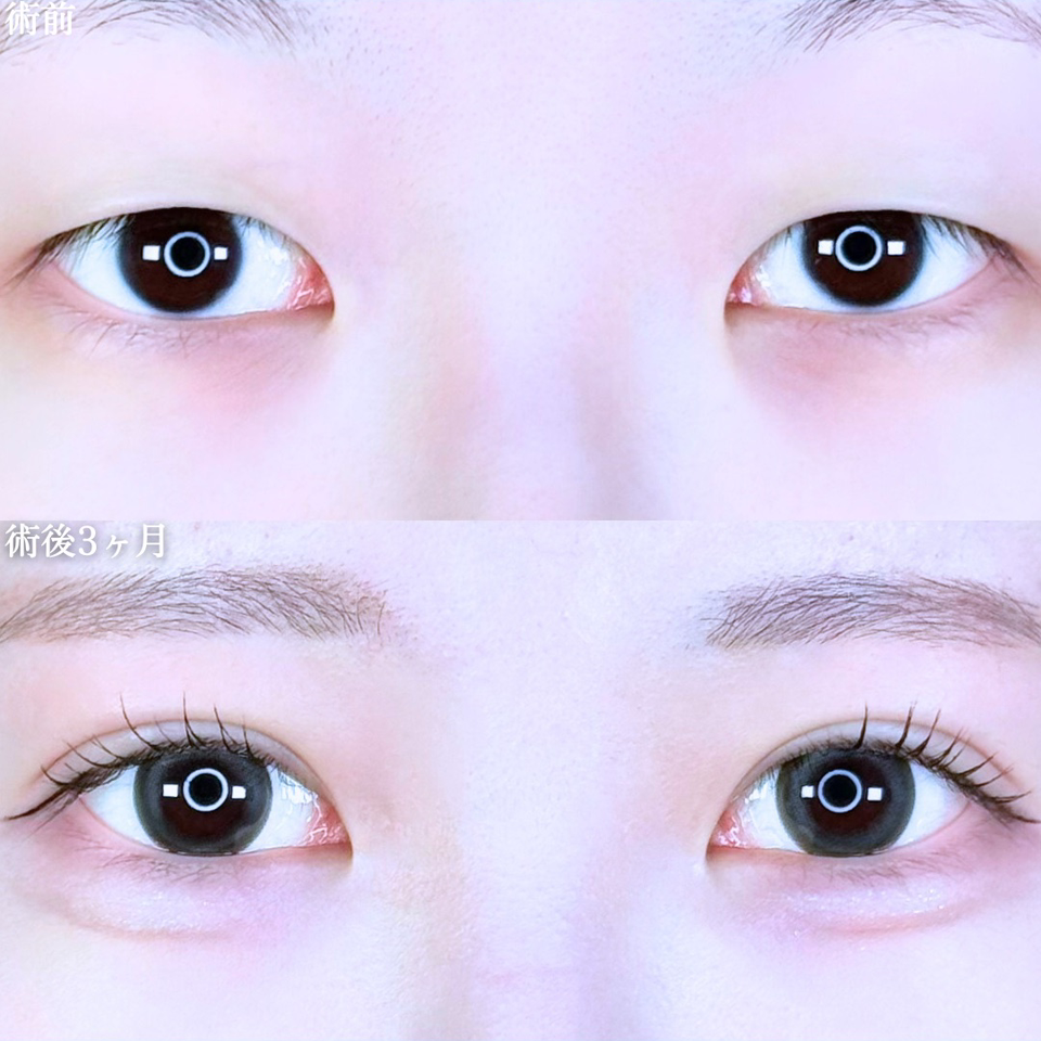 No.10980の症例写真