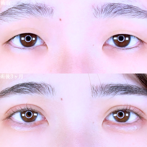 No.10578の症例写真