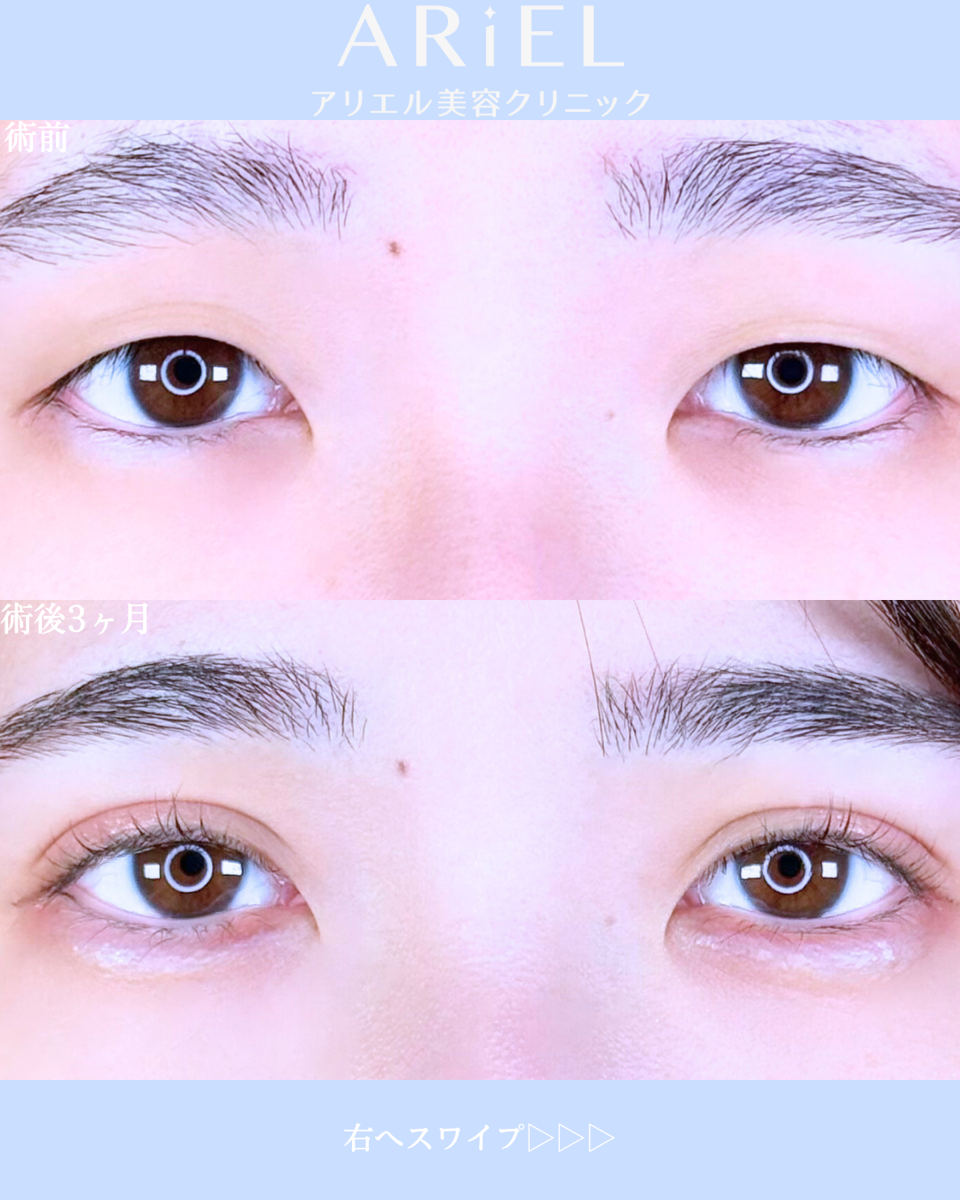 No.10578の症例写真