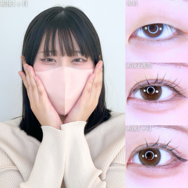 No.10535の症例写真 No.10535の症例写真