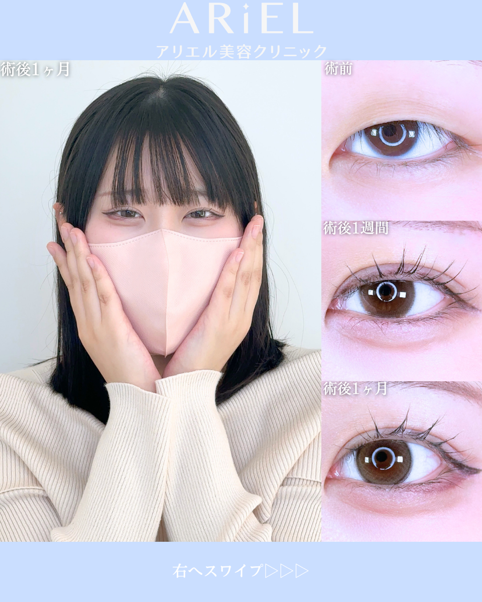 No.10535の症例写真