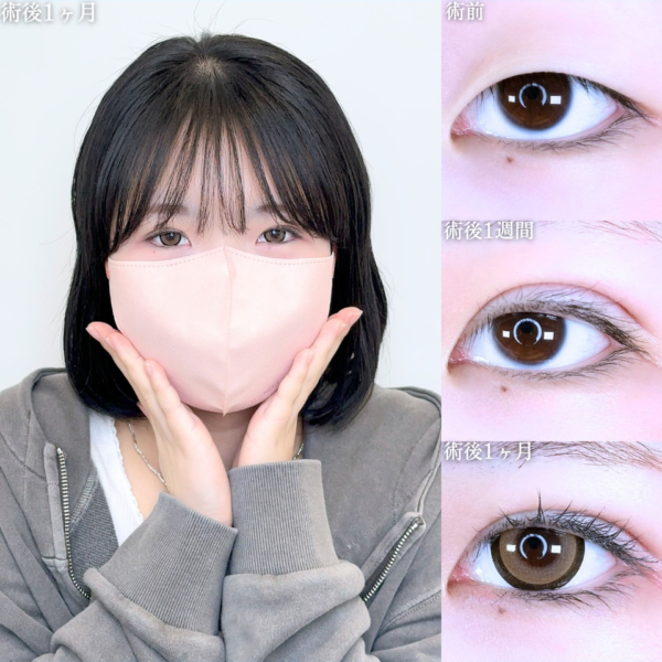 No.10757の症例写真