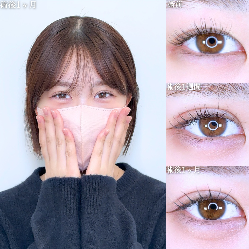 No.10997の症例写真