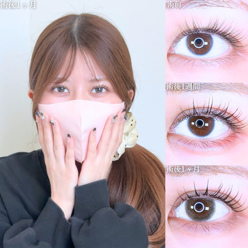 No.10796の症例写真