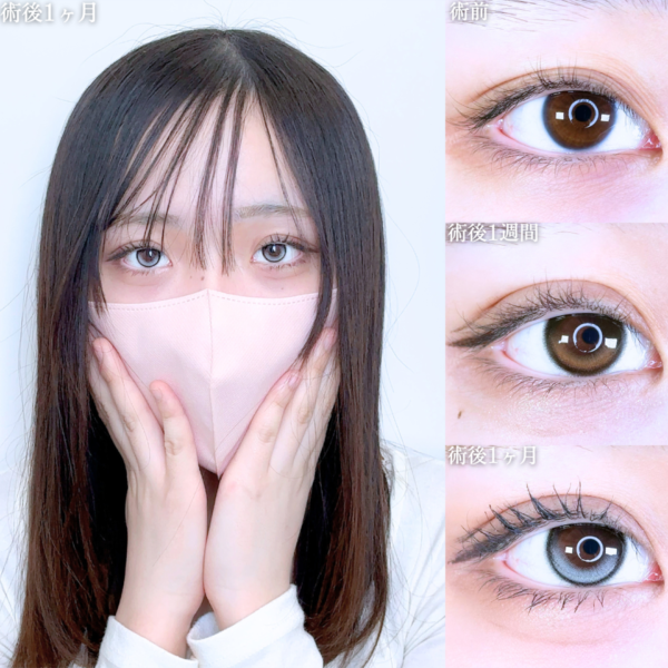 No.10814の症例写真 No.10814の症例写真