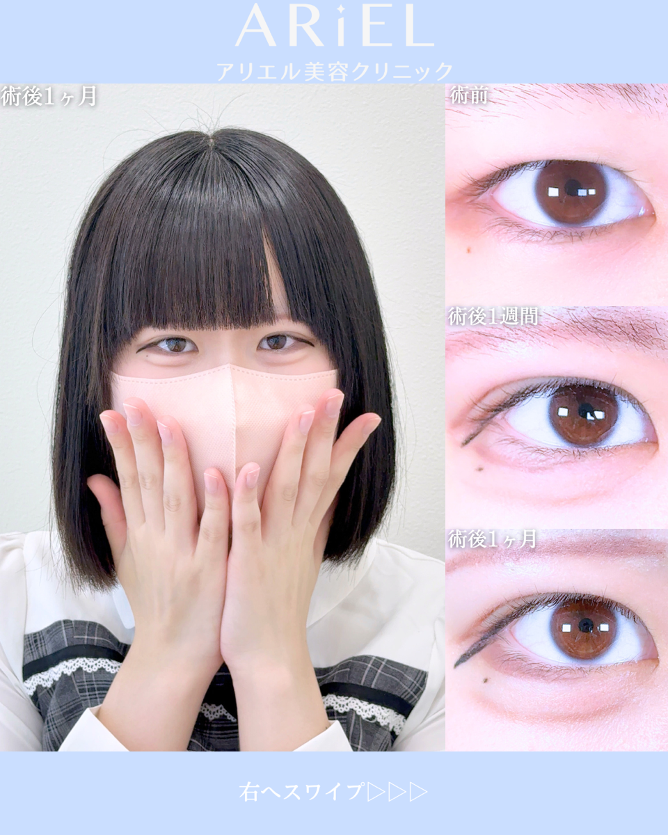 No.10585の症例写真