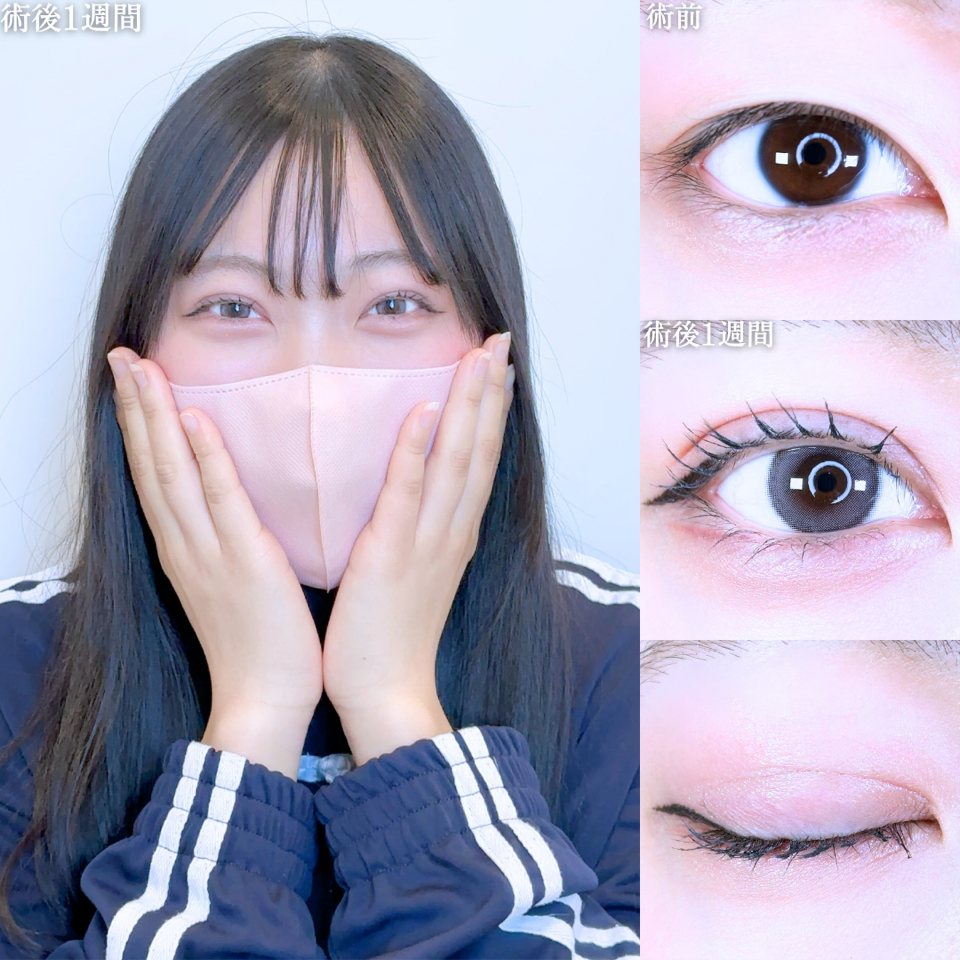 No.10846の症例写真