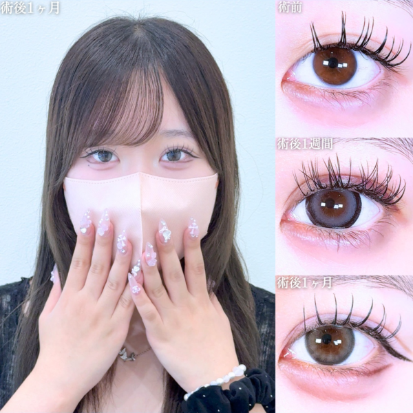 No.10907の症例写真