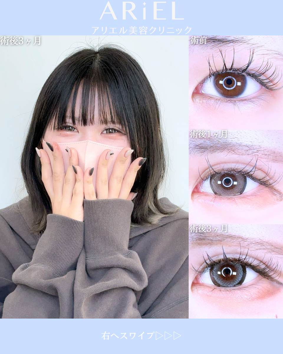 No.10591の症例写真