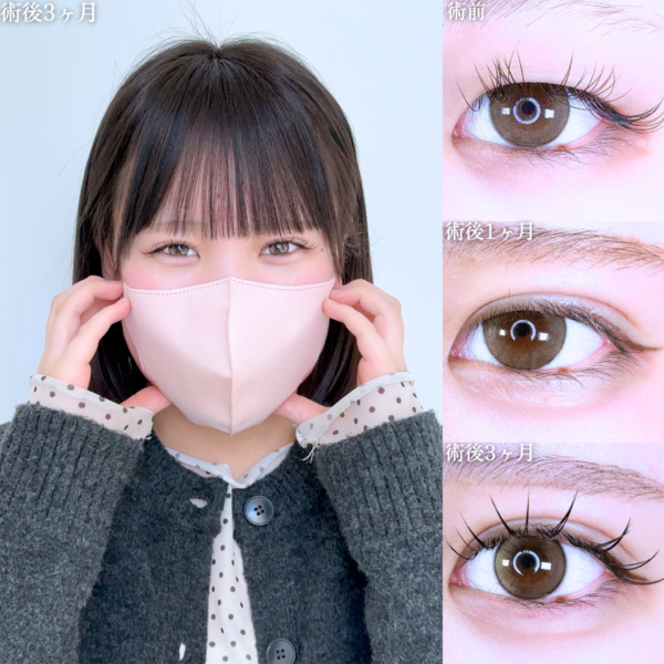 No.10852の症例写真 No.10852の症例写真