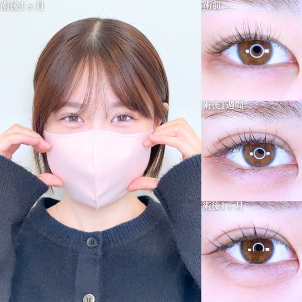 No.10621の症例写真