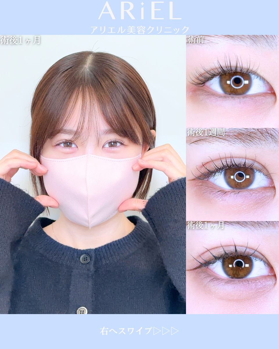 No.10621の症例写真